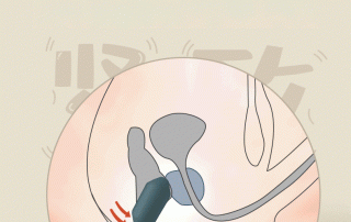 Anal Plug